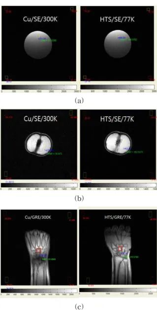 Fig.  2.  Measurement  of  reflection  coefficient  and  Q-factor  at  different  temperature  with  HTS  RF  coil.
