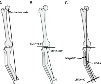 Fig. 8. Analysis of uniapical deformity of the tibia using the mechani- mechani-cal axis: Draw the mechanimechani-cal axis and measure MAD (A)