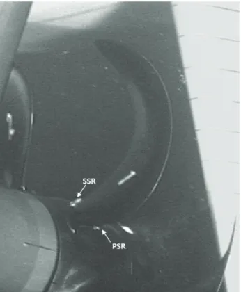 Fig. 11 SSR and PSR observed in Condition Group #2-4