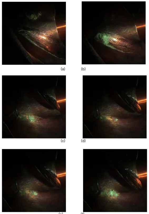 Fig. 6 Photo images on the sequential behaviors of cavitation pattern 
