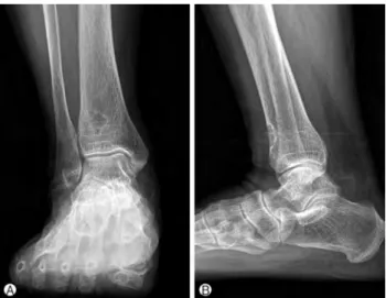 Fig. 3. Histologic appearance of chondromyxoid fibroma. (A) Low-power view (H-E, ×100) shows lobular pattern with hypercellular and hypocellular areas