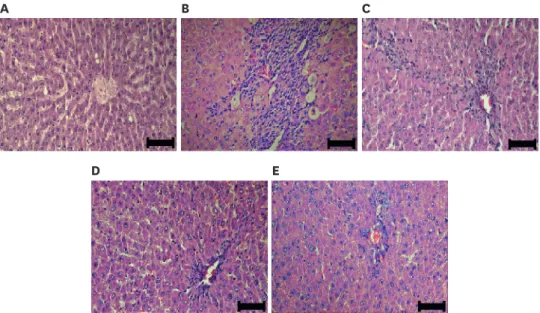 Fig. 5. Pathological observation (hematoxylin &amp; eosin) in liver tissue. Normal (A), Control (B), SM (C), ACL (D), and  ACH (E)