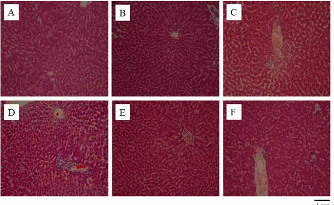 Fig. 4. Effects of silk protein hydrolysate on liver histology in rats treated with tert -butyl hydroperoxide ( t -BHP)