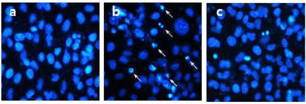 Fig. 8. Protective effect of mulberry sugar extracts (MSE) against H 2 O 2 -induced apoptosis in HepG2 cells.
