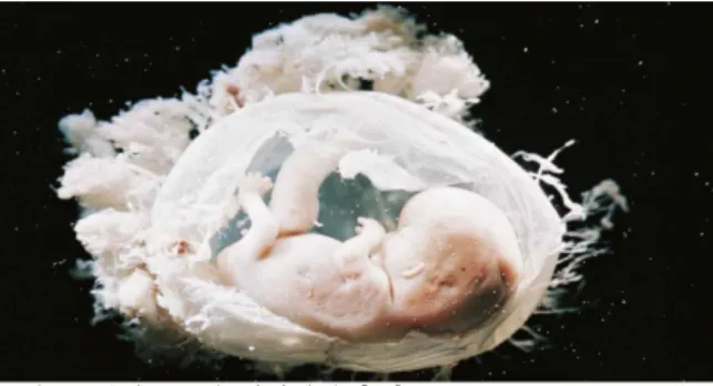 Figure 1. A human embryo at the ninth week of gestation