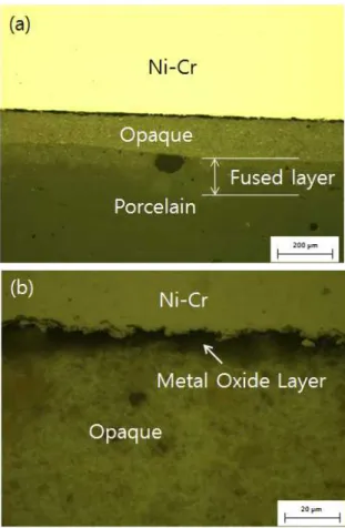 Fig.  3.  Optical  microscopic  images  of  porcelain  fused  to  Co-Cr  alloy.  (a)  shows  the  area  of  Co-Cr  alloy,  opaque,  and  porcelain  and  their  interfaces,  (b)  blow  up  of  the  interface  of  metal  and  opaque  in  (a).