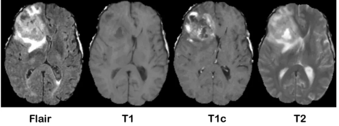 Fig. 4. Convert two-dimensional images to three-dimensional images.