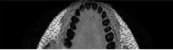 Fig.  9.  bad  image  quality(cropped  image)