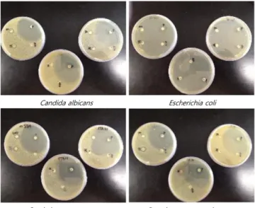 Fig. 1. Antibacterial effect of mixed plant extracts A by disc diffusion method.