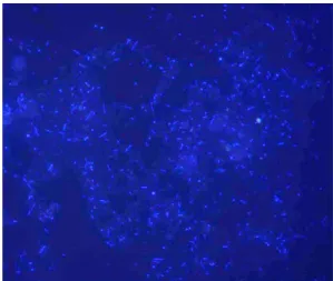 Fig. 7. Microbes from 1st sampling port of biofilter, observed by fluores- fluores-cence microscope (16×100) (Axiolab, Xeiss, Germany).