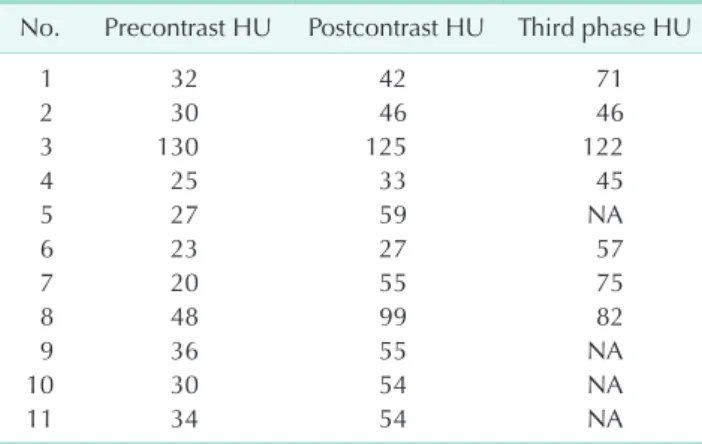 Table 3. Tumor density on computerized tomographic scans  pre- and postcontrast as well as late phase (11 of 25 patients)