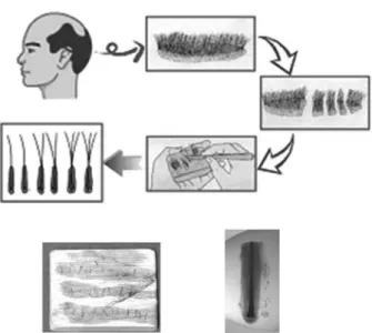 Fig. 1. Schematic diagram of procedure to isolate hair follicle from scalp dermis.