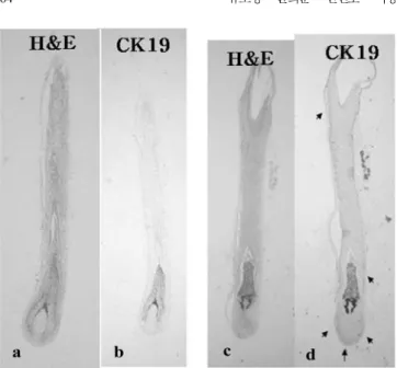 Fig. 9. Histological analysis of organ cultured hair follicles at 10th day (a, b: in Philpott medium; c, d: in DHGM) (Brown color indicates CK19-positive cells).