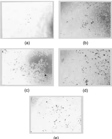 Fig. 4. Optical photographs of transfected 293 cells; 293 cells were seeded in a flat bottom 6-well plate, and DNA/DP-CS  com-plexes or DNA/lipofecamine comcom-plexes were added to the  6-well plate