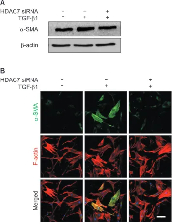 Fig. 4. Histone deacetylase 7 (HDAC7) knockdown inhibits transform- transform-ing growth factor-β1 (TGF-β1)-induced myofibroblastic  differentia-tion in fibroblasts derived from human Peyronie’s disease plaque