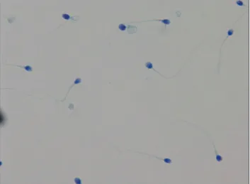 Fig. 1. Sperm viability test using eosin-nigrosin staining. Viable sperm  heads were unstained and non-viable sperm heads were stained  red-pink (×400).