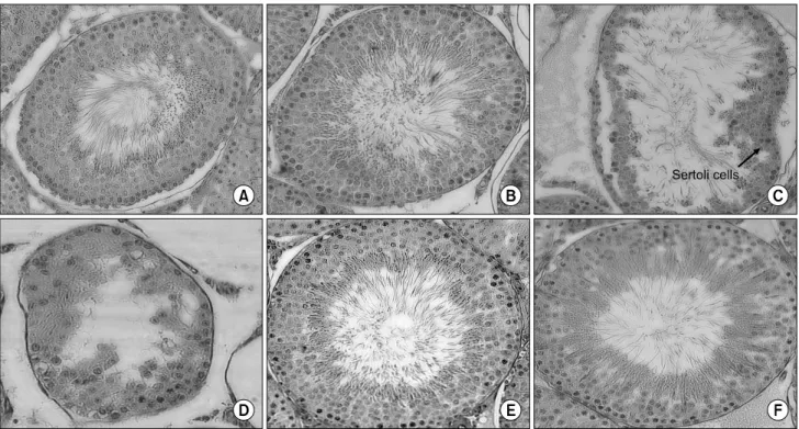 Fig. 1. Histological analysis of seminiferous tubules from normal controls, luteinizing hormone-releasing hormone (LHRH)-induced  infertility controls, LHRH-induced rats treated with testosterone, and LHRH-induced rats treated with 400 mg/kg of KH-465