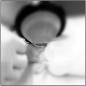 Fig. 1. Extracorporeal shockwave therapy (MT2000H) application time, and precise identification of the targeted structures within the surrounding anatomy [18].