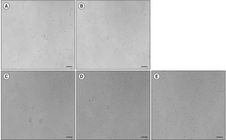 Fig. 3. Appearance of sperm after 28-day oral administration with KH-204. (A) Control, (B) KH-204 50 mg, (C) KH-204 100 mg, (D)  KH-204 200 mg, (E) KH-204 400 mg (×200 magnification).