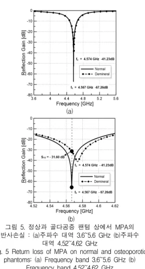 Fig.  4  Resonant  frequency  and  return  loss  of  MPA  on  the  phantom:  (a)  l  change  (b)      change