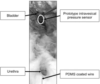 Fig.  2.  Prototype  intravesical  pressure  sensor  was  placed  into  the  intravesical  space.