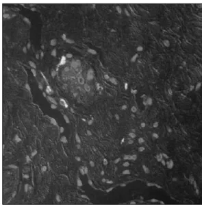 Fig.  2.  Fluorescence  was  confirmed  in  the  nuclear  area  of  the  corpus  cavernosal  smooth  muscle  cells  in  the  injected  site  of  the  stromal  vascular  fraction  (SVF)