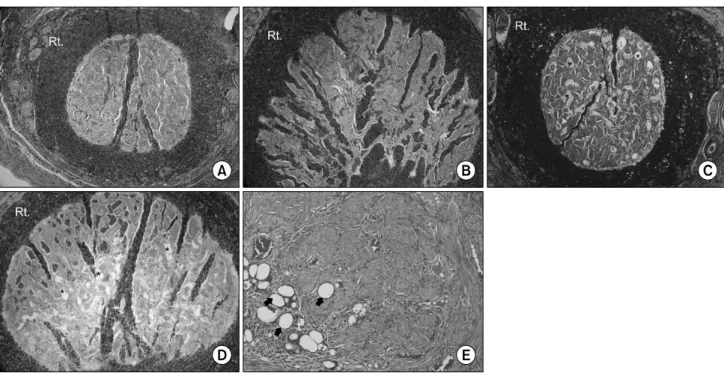 Fig.  3.  Section  of  corpus  cavernosum  with  Masson-trichrome  stain.  (A)  Normal  control  group