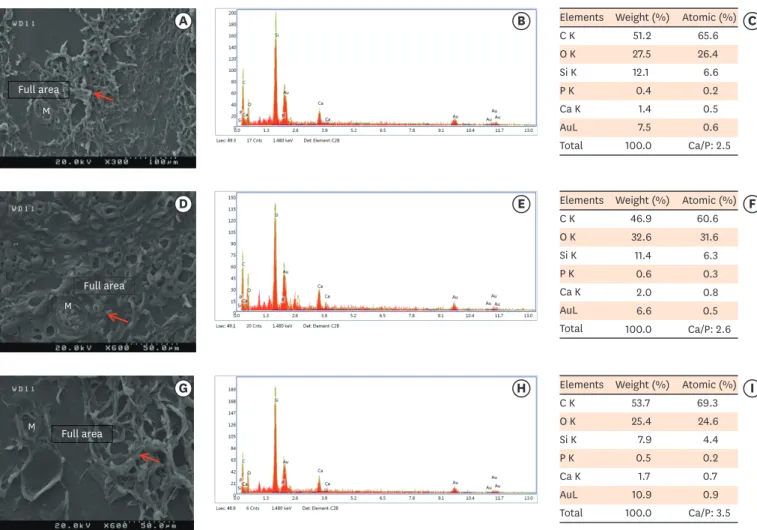 Figure 2. Scanning electron microscopy observations and elemental composition obtained using energy-dispersive X-ray analysis of the surface precipitates  produced by (A-C) MM-MTA, (D-F) BD, and (G-I) ESRRM putty at 7 days after the subcutaneous implantati