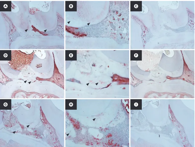 Figure 5. Dentin sialoprotein (DSP) expression of pulp capped rat molar teeth using mineral trioxide aggregate (MTA) with or without osteostatin (OST)