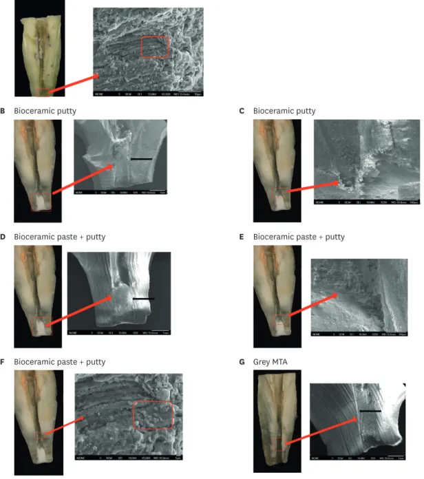 Figure 4. Scanning electron microscopic (SEM) images demonstrated the surface canal interface for the positive control and the experimental groups