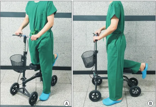 Figure 2. The images of male using knee  walker are shown. (A) Oblique image. (B)  Lateral Image.