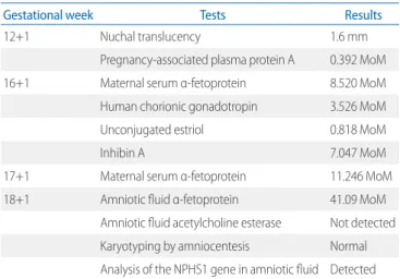 Fig. 1. Sequencing chromatogram of the CNS proband. Sequence  analysis of the proband and parents demonstrated c.619del (A) and  c.1105C>T (B) of the NPHS1 gene