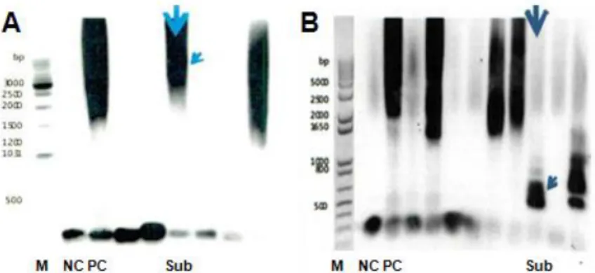 Fig. 1.  Southern blot of long-range PCR products from the CTG copies in the DMPK  gene