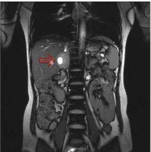 Fig. 1. Magnetic resonance imaging of the abdomen. 