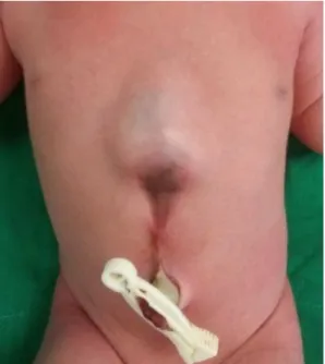 Fig. 1. This image of the patient shows pulsating and pro­