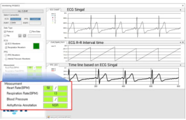 그림  2.  ECG  측정과  분석을  위한  사용자  인터페이스 Fig  2.  The  User  Interface  for  ECG  measurement  and 