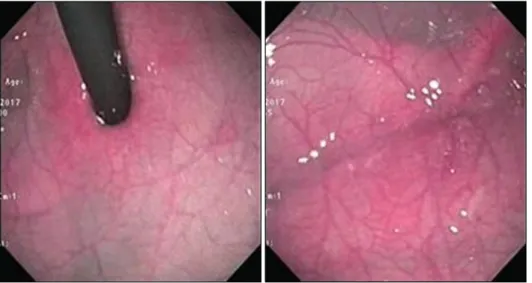 Fig. 2.  Control endoscopy  images.