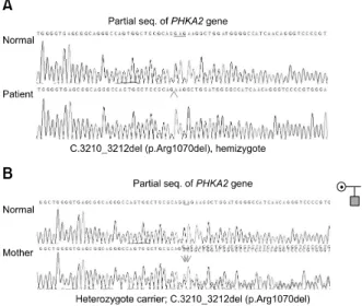 Fig. 2.  Partial genomic sequences of the PHAK2 gene. (A) The patient is a homozygotefor the c.3210_3212del (p.Arg1070del)  mutation