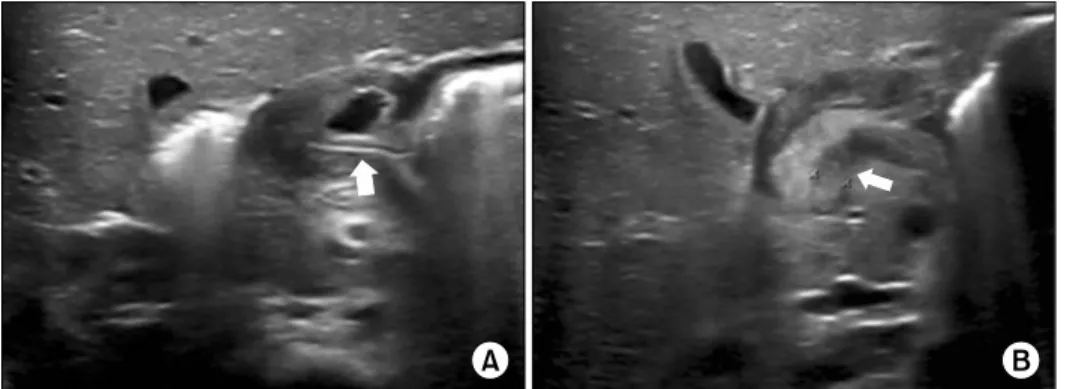 Fig. 1.  Abdomen ultrasonography.