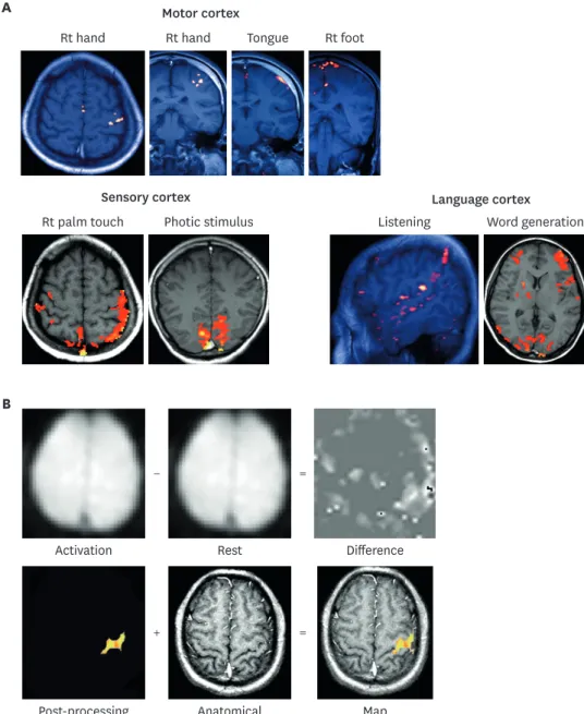 FIGURE 11. Physics of functional magnetic resonance image acquisition. (A) Resting state functional MRI