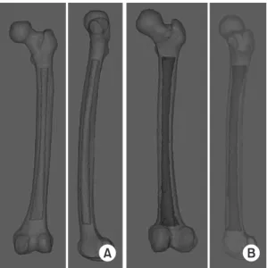 Fig. 5. Despite the increased anterolateral bowing, (A) the medullary  canal of the atypical femur tended to be straightened on the  antero-posterior projection, and the anterior bowing was increased markedly