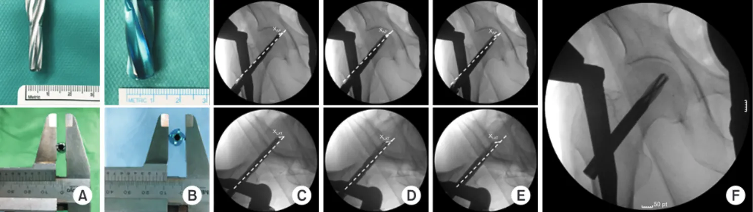 Fig. 1. (A, B) True reamer head and blade diameter was measured in two ways using a ruler and calipers