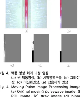 Fig. 3. The Proposed Moving Pulse wave Processing Diagram of  for Measuring a Pulse Wave