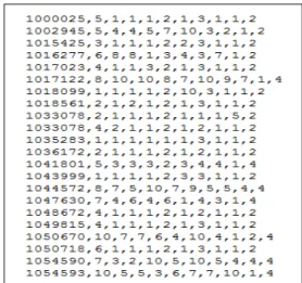 그림 4. breast cancer dataset의 데이터 일부 Fig. 4. part of breast cancer dataset