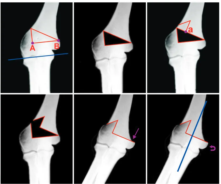 Fig. 3. Step-cut osteotomy. Cited from the article of Moradi et al. (Clin Orthop Relat Res, 471: 1564-1571, 2013) with original copyright holder ’s  permission