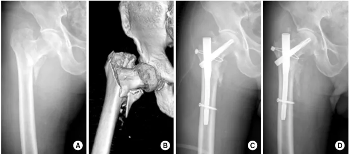 Fig. 1. An 83-year-old male with right hip pain. 