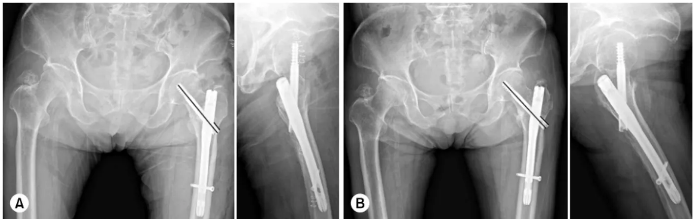 Table 7. Comparison of Radiographic Results