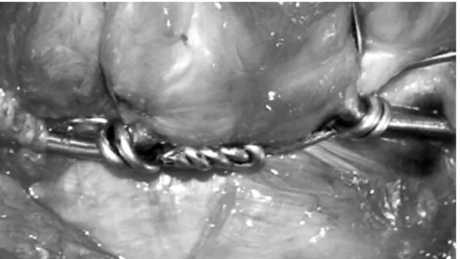 Fig. 7. Magnified picture of the dotted rectangular area of  Fig. 6 demonstrating anti-gliding loops.