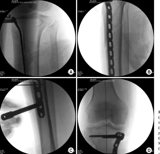 Fig. 2. Fluoroscopic findings.