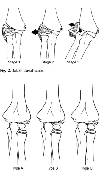 Fig. 2. Jakob classification.